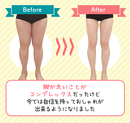下半身ビフォーアフター写真