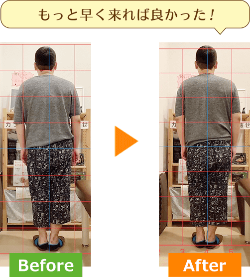 ビフォーアフター2